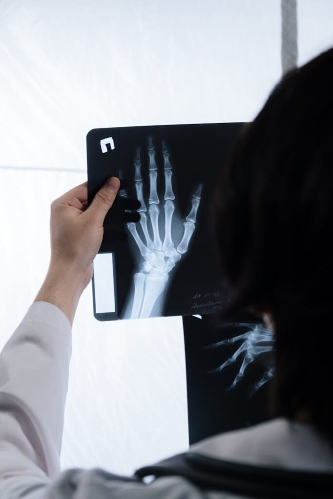 Person Holding a Hand X-Ray 